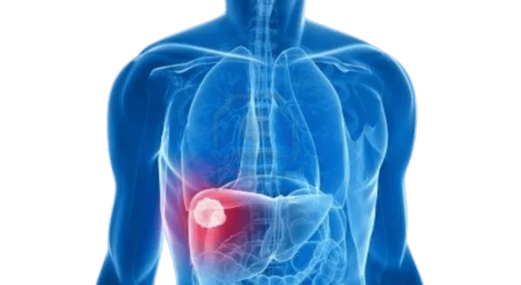 Symptoms That May Indicate Liver Cancer