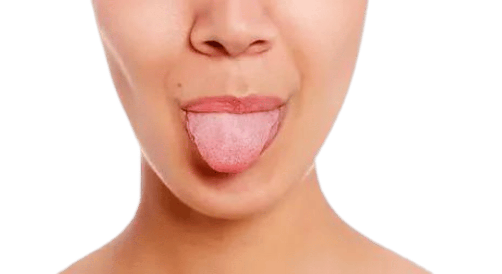 What Your Tongue Says About Your Health